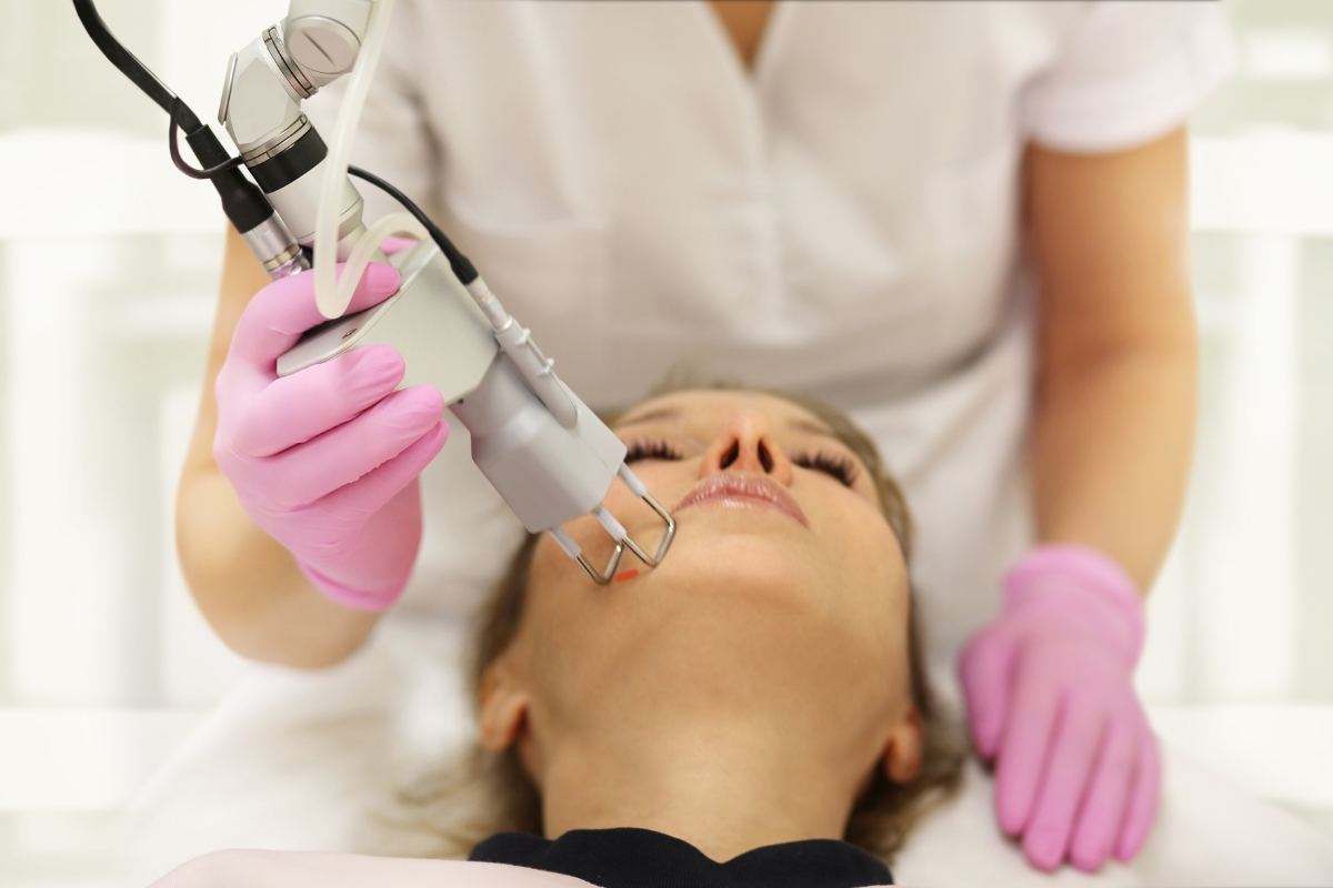 Laser Scar Treatment