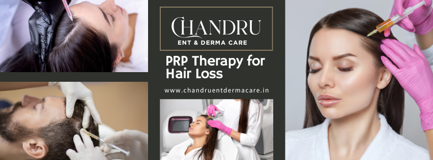 PRP Therapy for Hair Loss: Using Your Own Platelets to Support Hair Growth