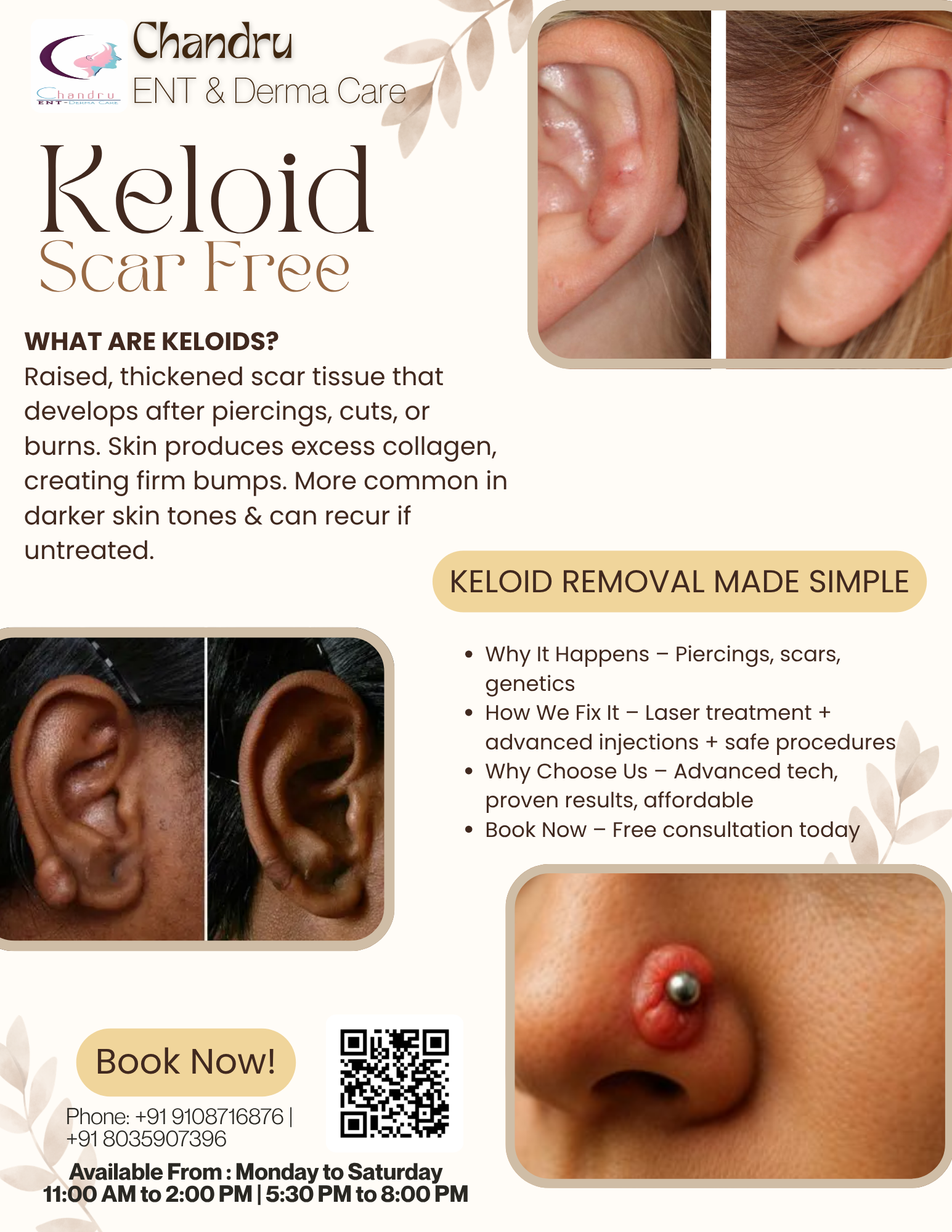 Keloids Be Scar Free