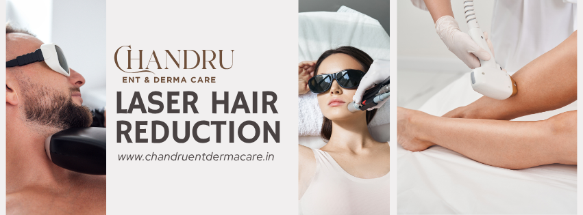 Laser Hair Reduction for Indian Skin: What You Should Know